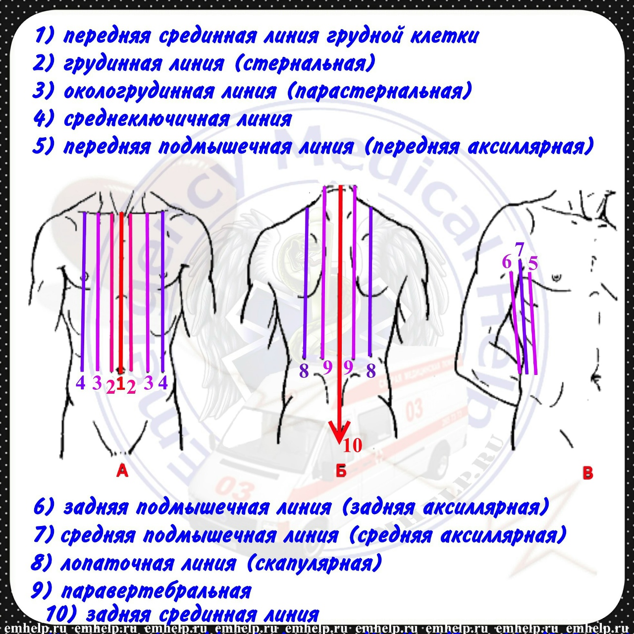 Маммопластика. Выбор силиконовых имплантов для увеличения груди.
