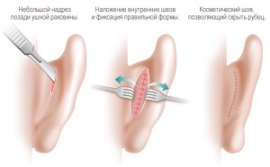 Ход операции